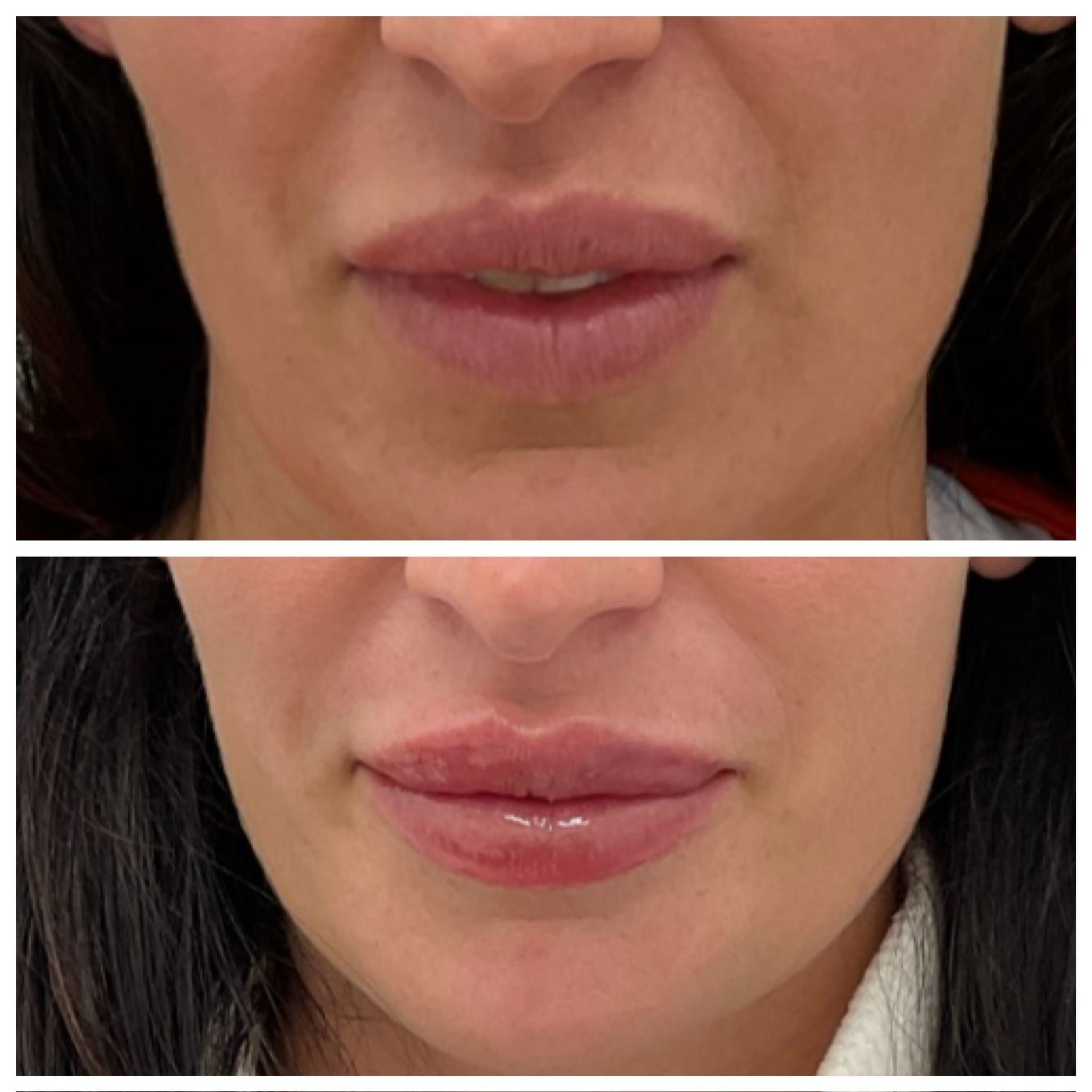 A before and after photo of a woman 's lips.