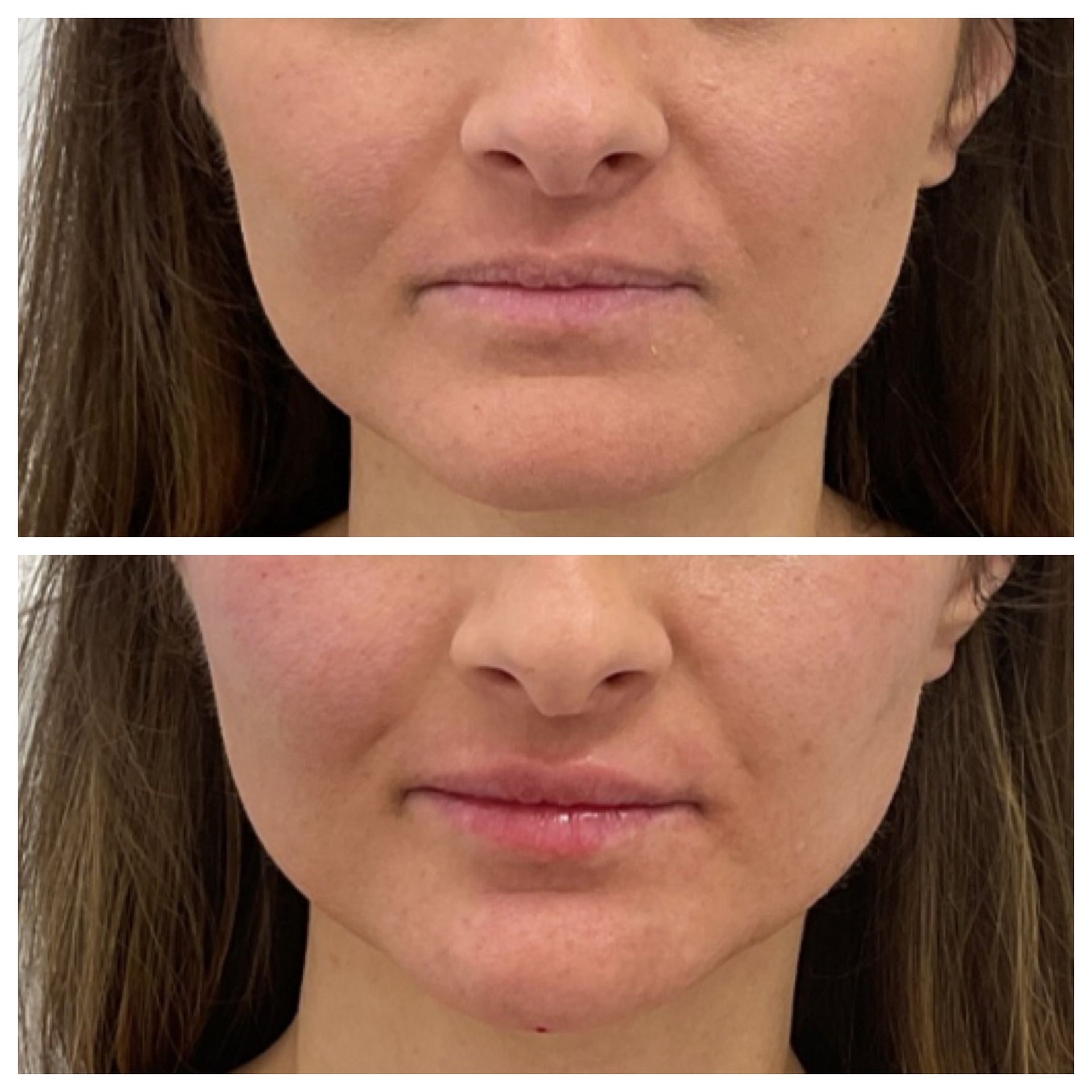 A before and after photo of a woman 's face.