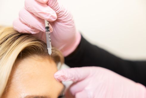 A woman is getting a botox injection in her forehead.