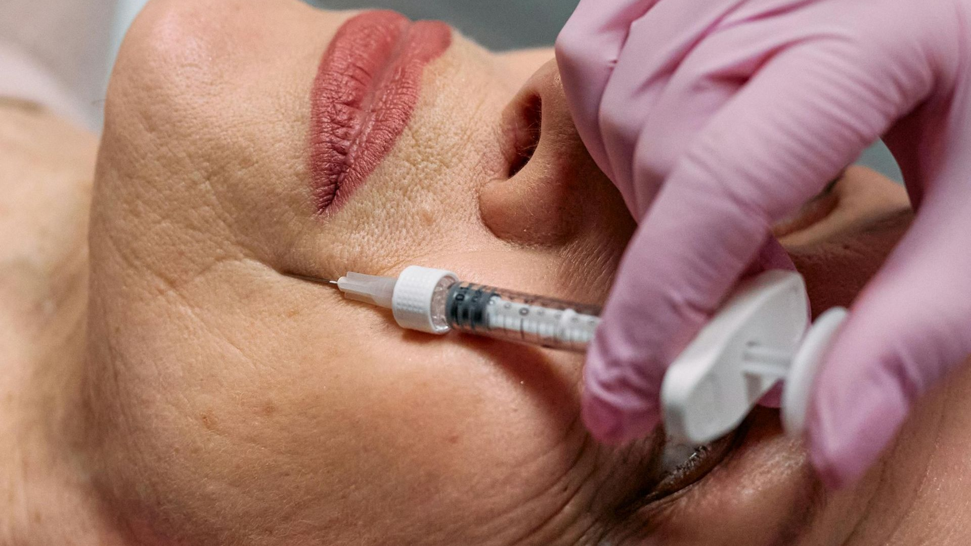 woman receiving Botox or Daxxify neurotoxin in CT