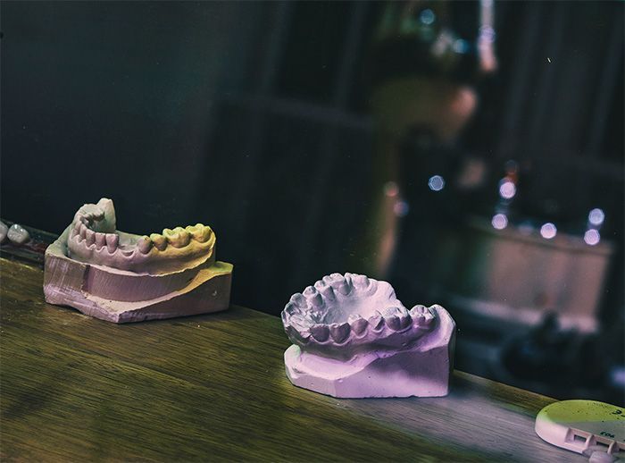 Twee modellen van tanden staan op een houten tafel.