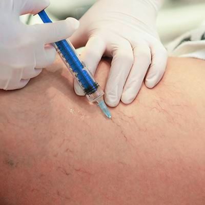Foto zum Thema ästhetische Chirurgie