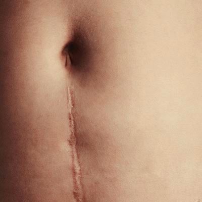 Foto zum Thema ästhetische Chirurgie