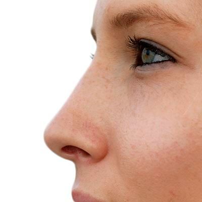 Foto zum Thema plastische Chirurgie