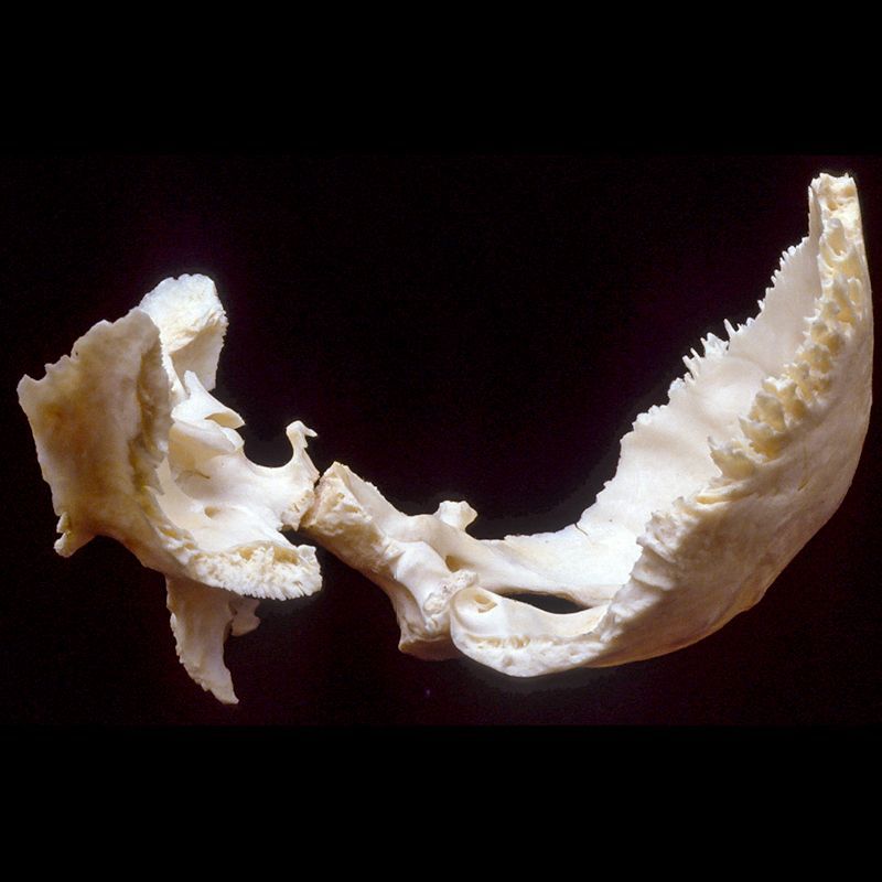 A close up of a human skull on a black background.