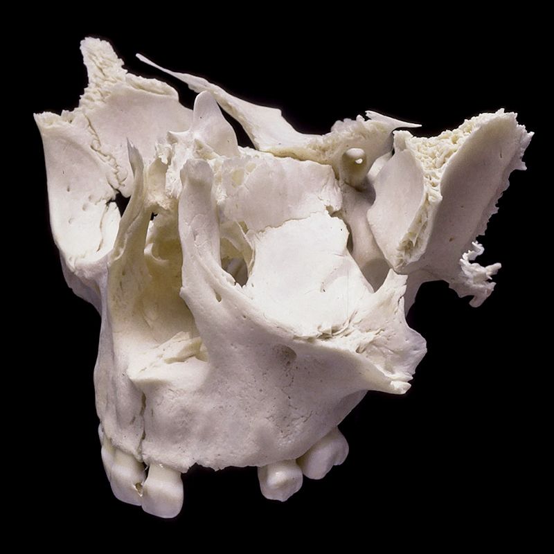 A close up of a skull on a black background