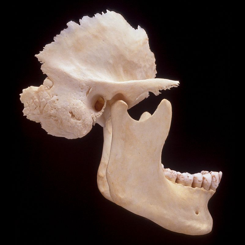 A close up of a skull with a black background
