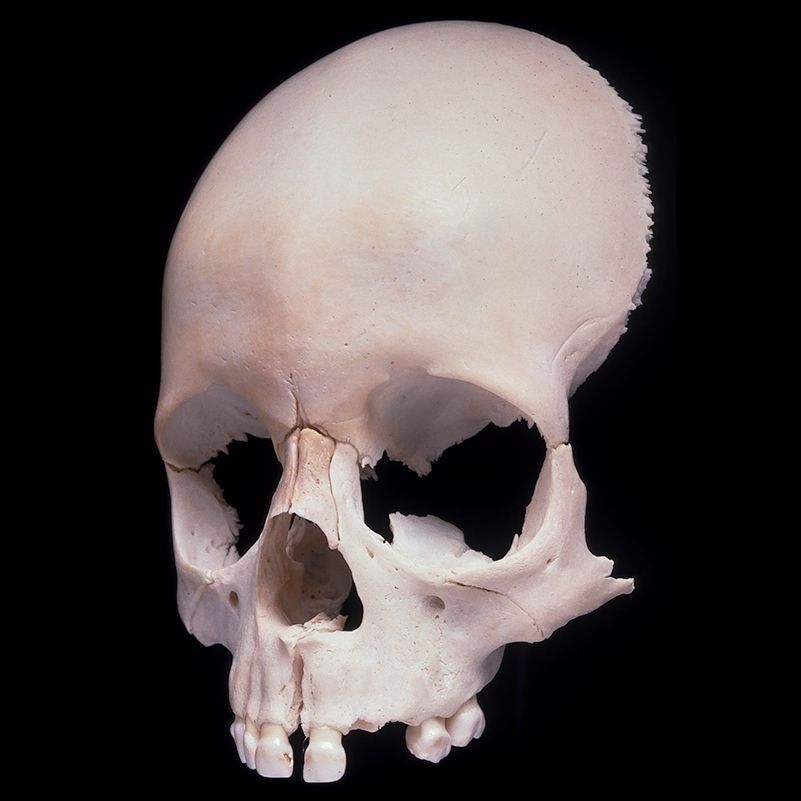 A close up of a human skull on a black background