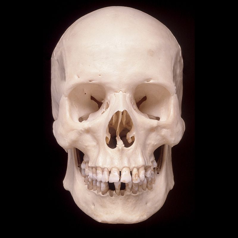 A close up of a human skull with teeth on a black background