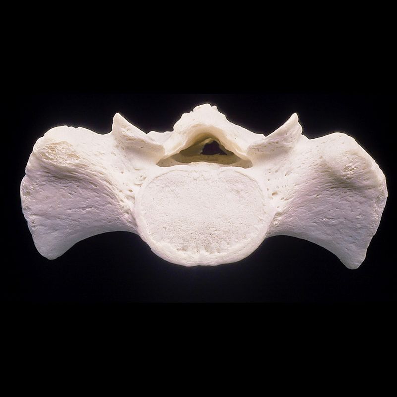 A close up of a skull with a hole in it