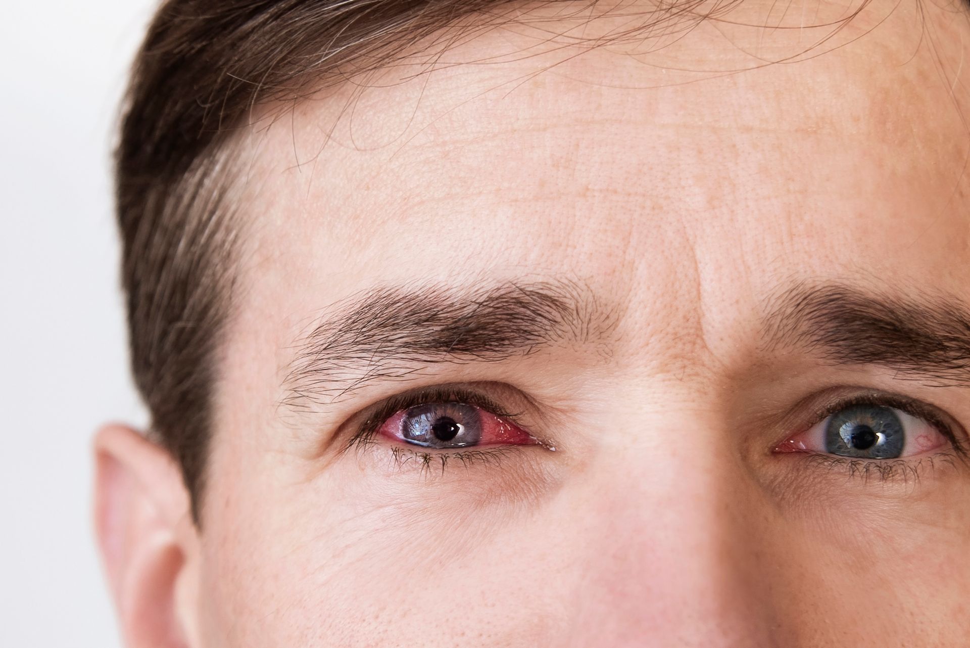 A man with red eyes.