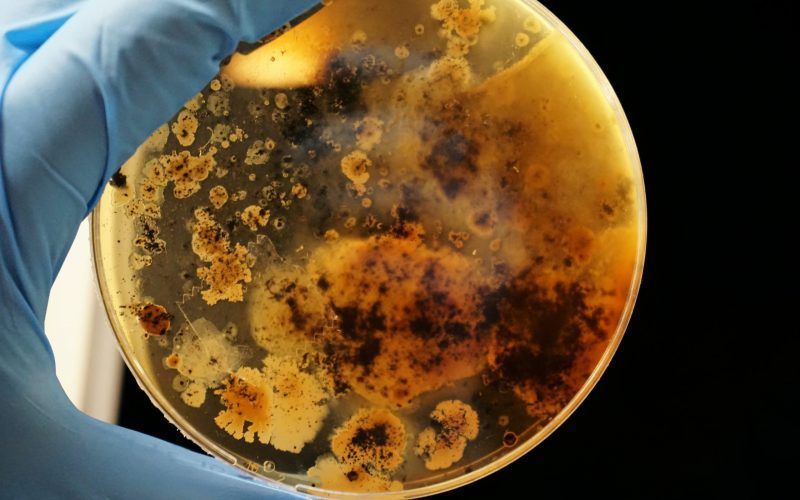 A person is holding a petri dish with a lot of bacteria on it.