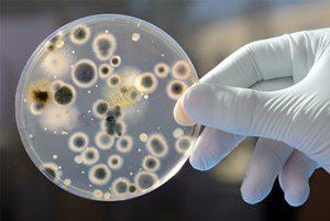 A person is holding a petri dish filled with bacteria.