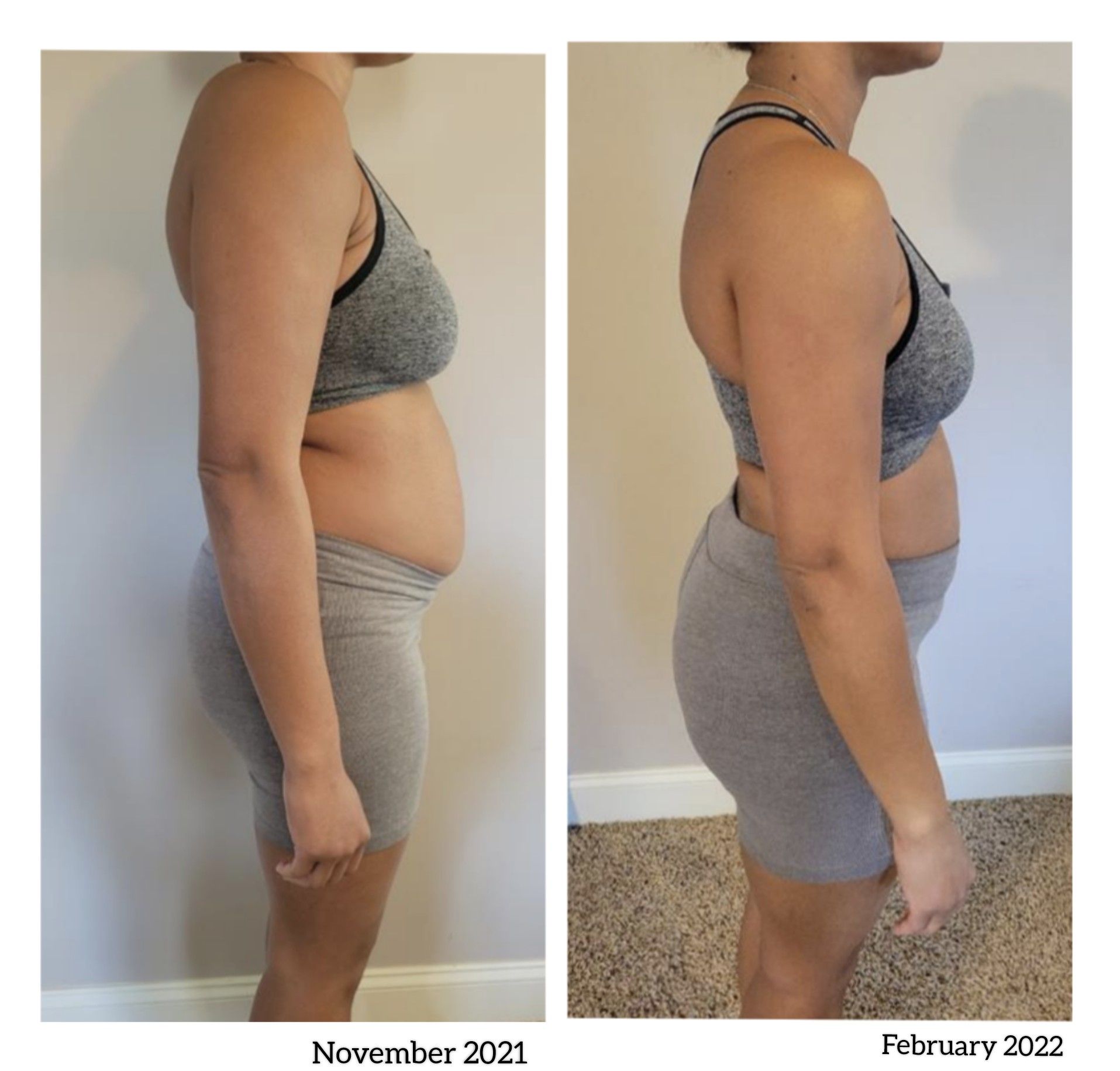 A before and after photo of a woman 's stomach.