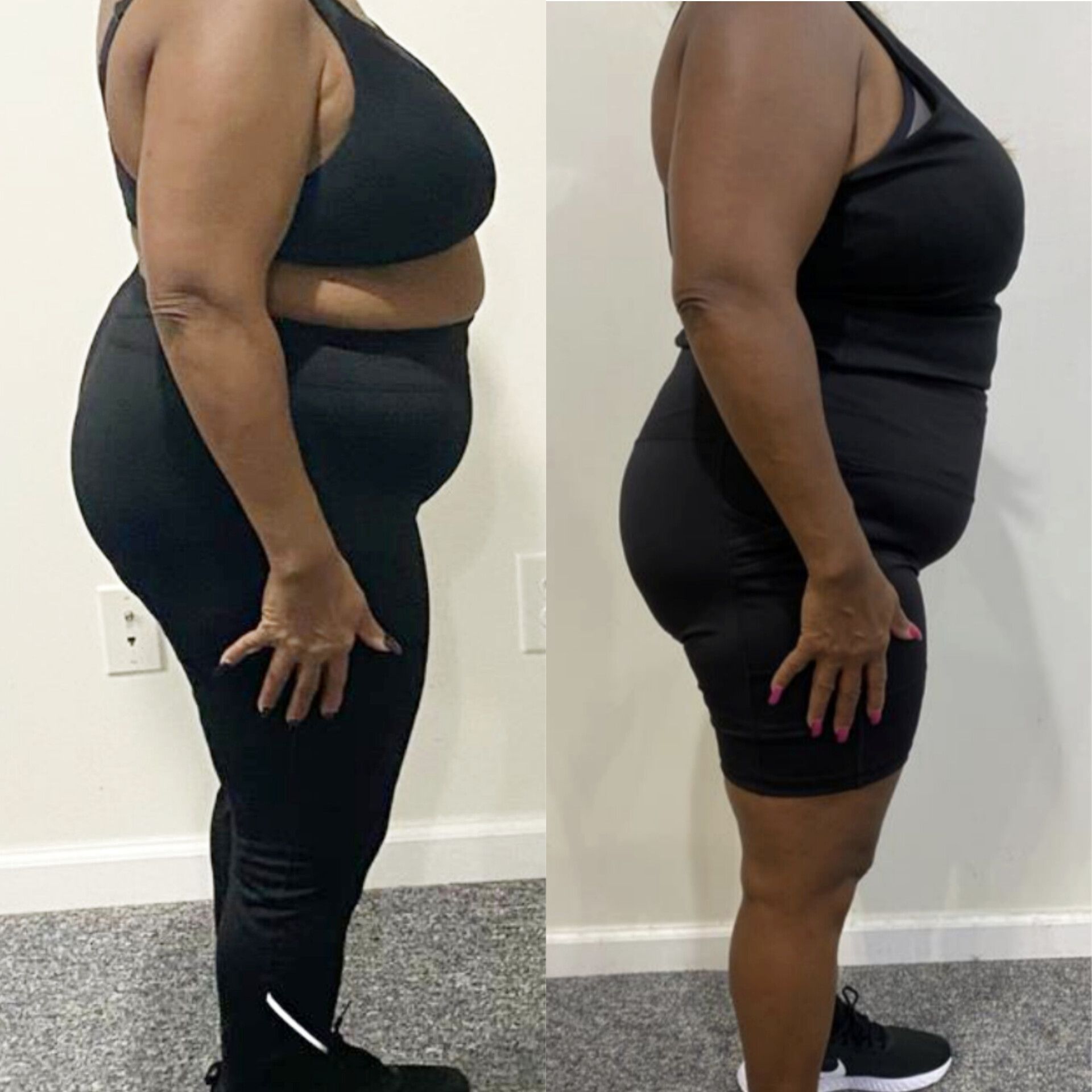 A before and after photo of a woman 's weight loss