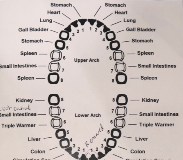 Dental