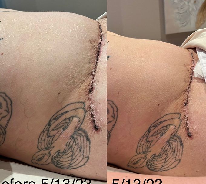 Same day transformation!