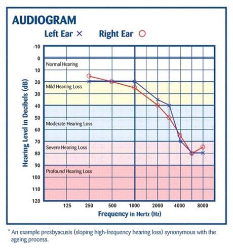 audiogram - Hearing Aid in Kittery, ME