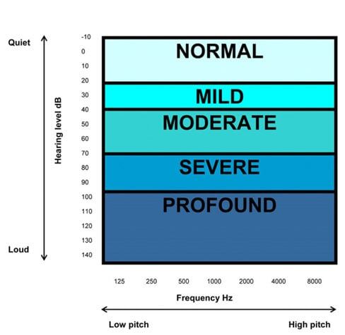 severities of hearing loss - Hearing Aid in Kittery, ME