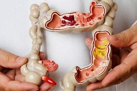 DR. GERARDO GONZÁLEZ COLOPROCTÓLOGO Y CIRUJANO GENERAL