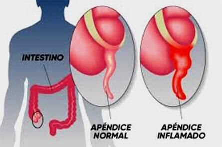 DR. GERARDO GONZÁLEZ COLOPROCTÓLOGO Y CIRUJANO GENERAL