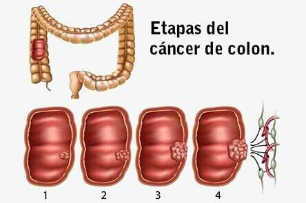 DR. GERARDO GONZÁLEZ COLOPROCTÓLOGO Y CIRUJANO GENERAL