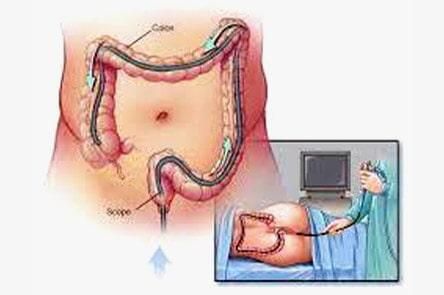 DR. GERARDO GONZÁLEZ COLOPROCTÓLOGO Y CIRUJANO GENERAL