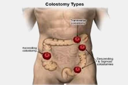 DR. GERARDO GONZÁLEZ COLOPROCTÓLOGO Y CIRUJANO GENERAL