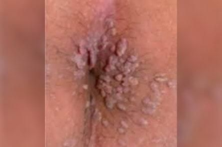 DR. GERARDO GONZÁLEZ COLOPROCTÓLOGO Y CIRUJANO GENERAL