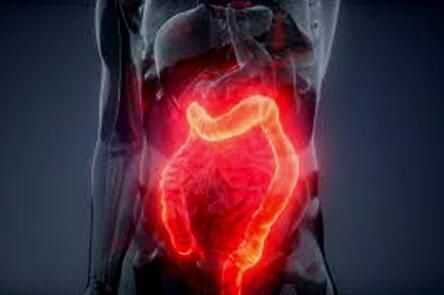 DR. GERARDO GONZÁLEZ COLOPROCTÓLOGO Y CIRUJANO GENERAL