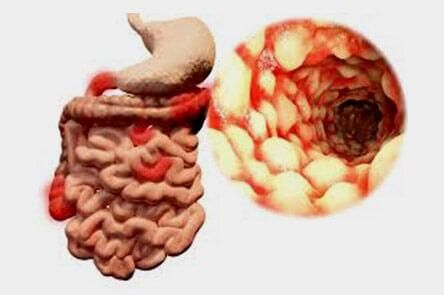 DR. GERARDO GONZÁLEZ COLOPROCTÓLOGO Y CIRUJANO GENERAL