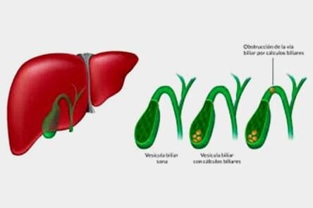 DR. GERARDO GONZÁLEZ COLOPROCTÓLOGO Y CIRUJANO GENERAL