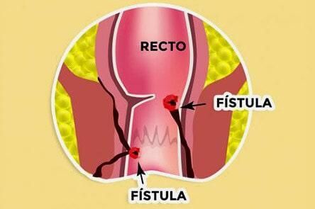 DR. GERARDO GONZÁLEZ COLOPROCTÓLOGO Y CIRUJANO GENERAL