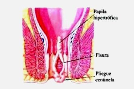 DR. GERARDO GONZÁLEZ COLOPROCTÓLOGO Y CIRUJANO GENERAL
