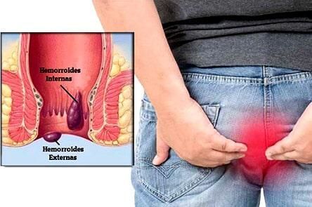 DR. GERARDO GONZÁLEZ COLOPROCTÓLOGO Y CIRUJANO GENERAL