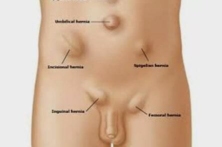 DR. GERARDO GONZÁLEZ COLOPROCTÓLOGO Y CIRUJANO GENERAL