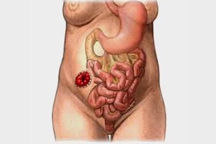 DR. GERARDO GONZÁLEZ COLOPROCTÓLOGO Y CIRUJANO GENERAL