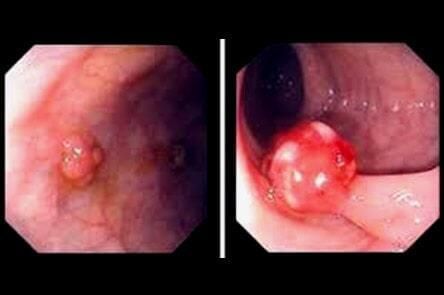 DR. GERARDO GONZÁLEDR. GERARDO GONZÁLEZ COLOPROCTÓLOGO Y CIRUJANO GENERALZ COLOPROCTÓLOGO Y CIRUJANO GENERAL