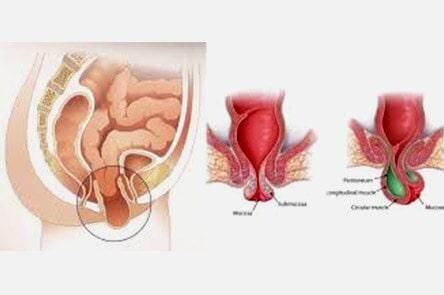 DR. GERARDO GONZÁLEZ COLOPROCTÓLOGO Y CIRUJANO GENERAL