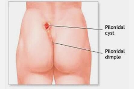 DR. GERARDO GONZÁLEZ COLOPROCTÓLOGO Y CIRUJANO GENERAL