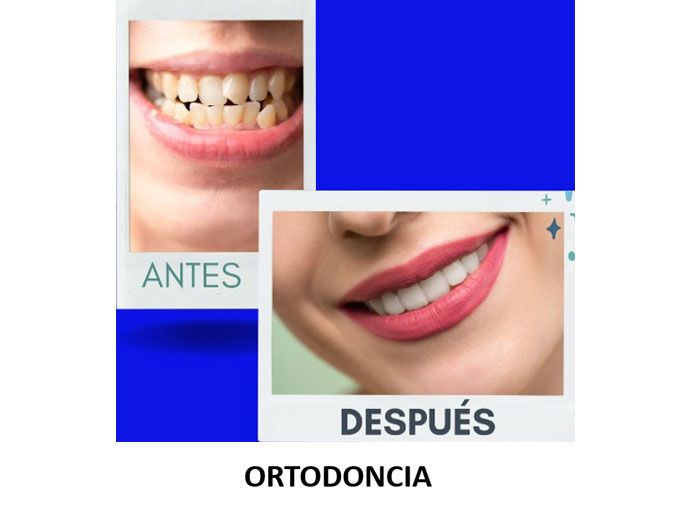 SMILIN CONSULTORIO DENTAL - ORTODONCIA