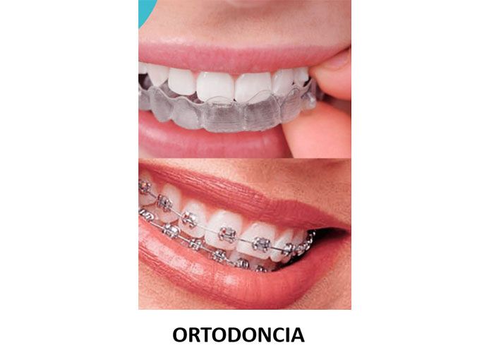 SMILIN CONSULTORIO DENTAL - ORTODONCIA