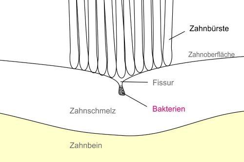 Schematische Darstellung der Fissuren
