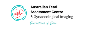 a white background with a few lines on it