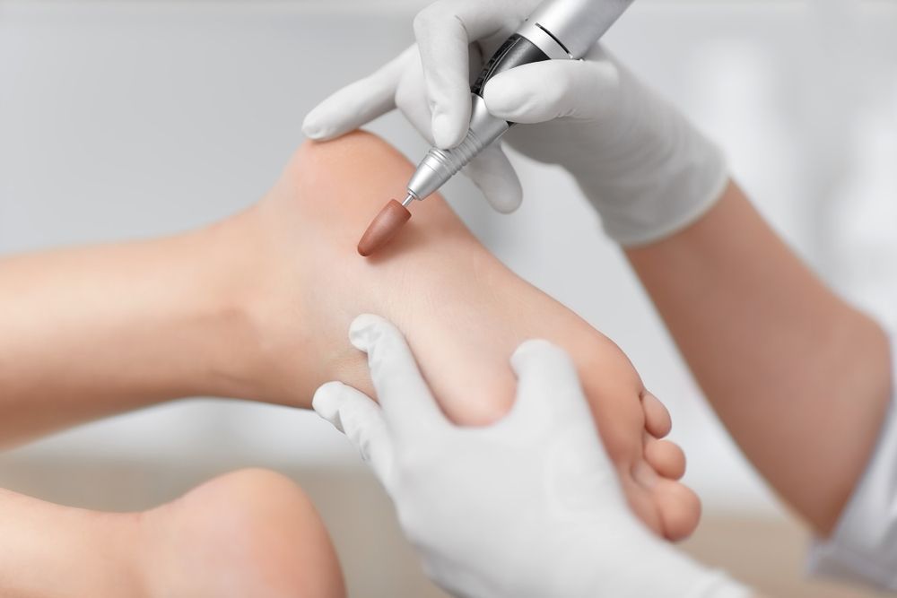 A Person is Getting a Pedicure on Their Foot — Craig Hughes Podiatry in Mount Hutton, NSW