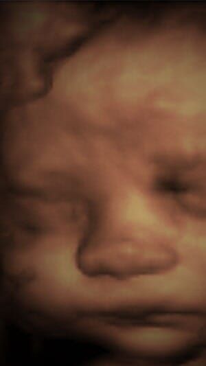 Un primer plano de la cara de un bebé con los ojos cerrados.