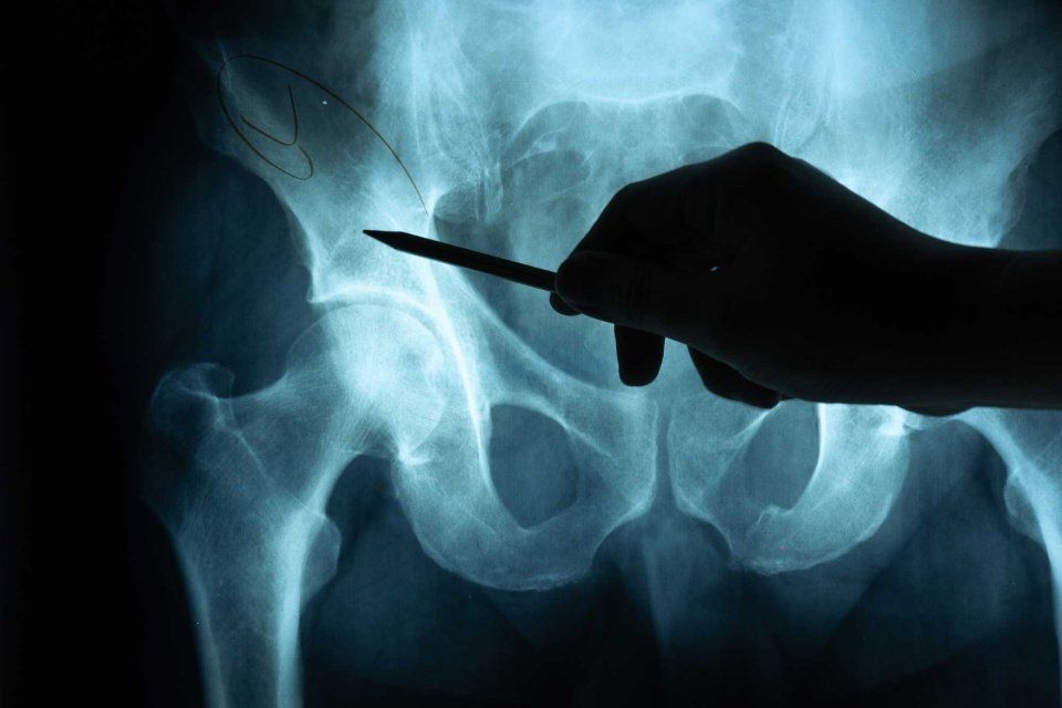 Radiografia bacino