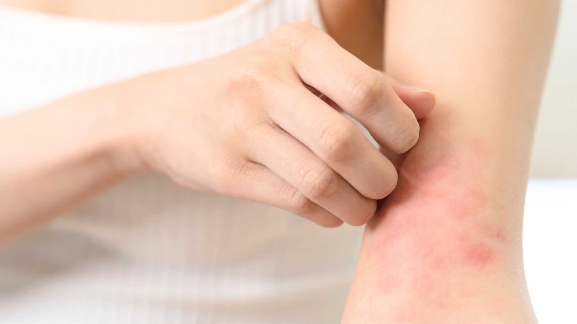 Have you noticed itchiness when taking Wegovy (semaglutide)? Learn what's normal 