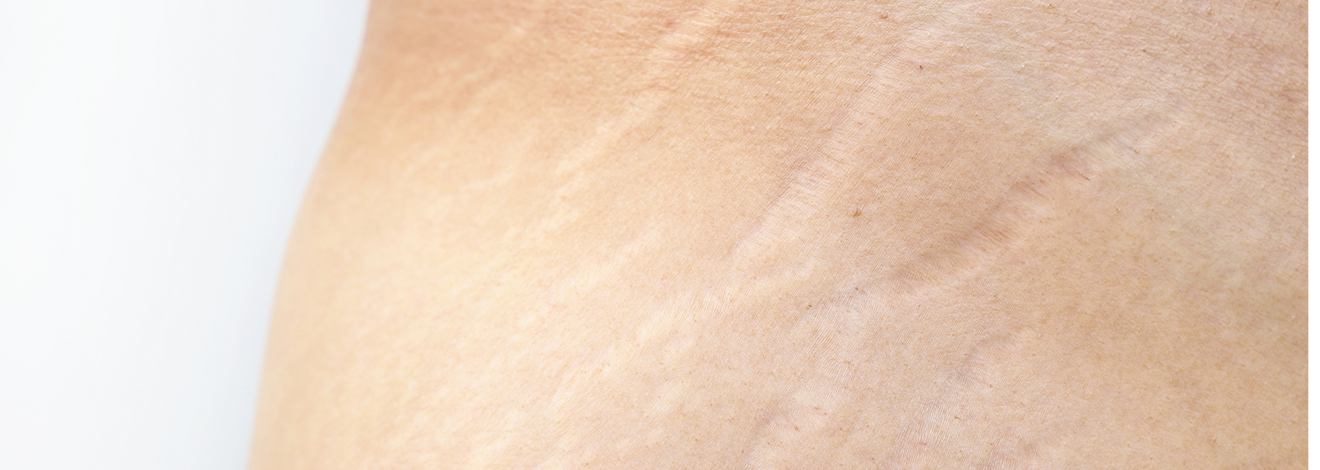 Picture of a close-up of a person's skin. Picture of a close-up of a person's skin.