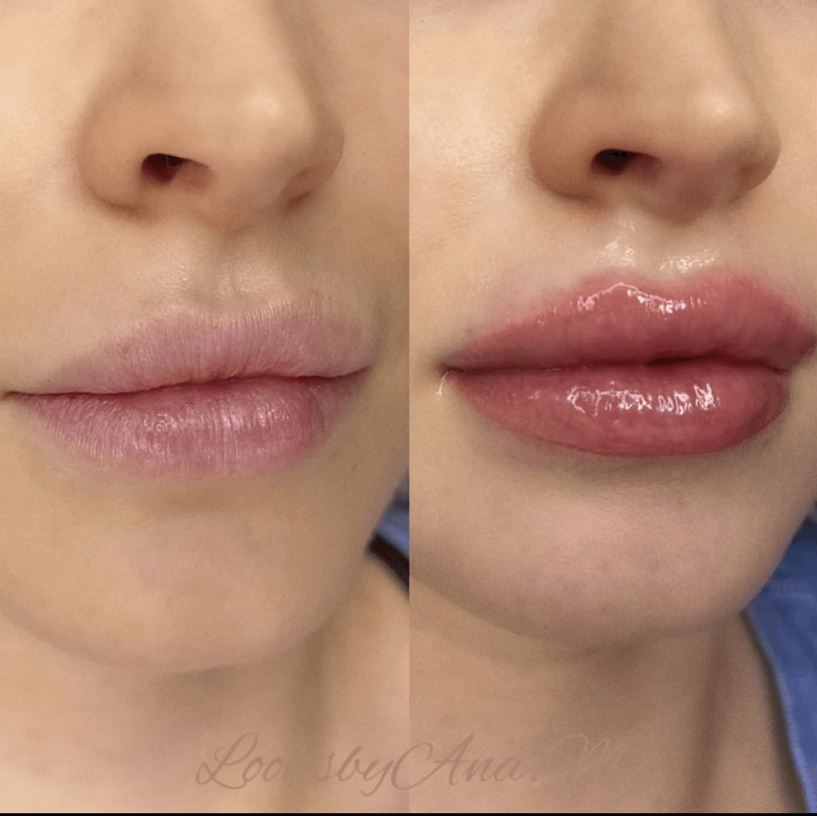 side by side photos of women's lips after lip blushing